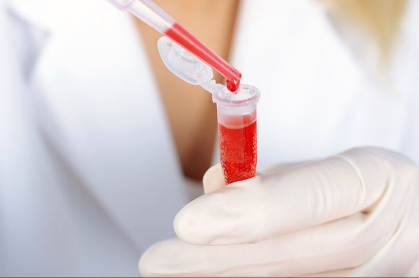 Día Mundial de la hemofilia: la importancia de acceder a un tratamiento adecuado